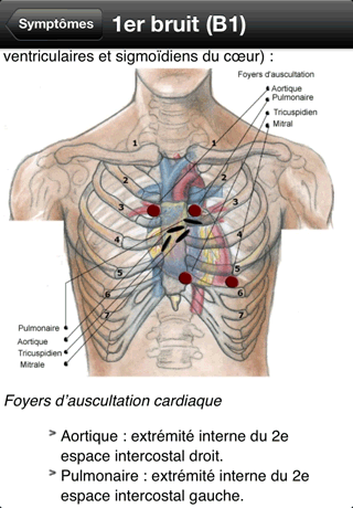 Клапаны сердца на грудной клетке. Проекция клапанов сердца на переднюю грудную. Схема проекции клапанов сердца. Проекции и точки аускультации клапанов сердца. 4 Межреберье аускультация сердца.